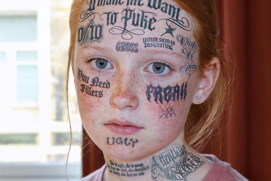 A child with abusive tattoos apparently inked on her face
